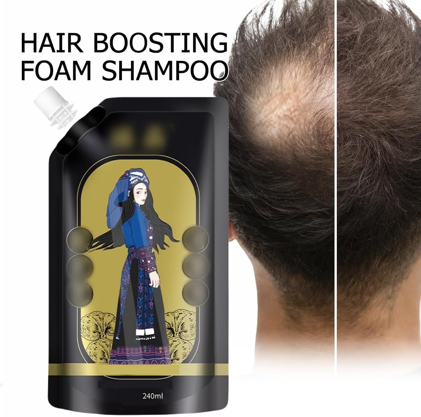 Gingerra™️Ginger Extract Anti-Hairfall Shampoo (Pack of 3)